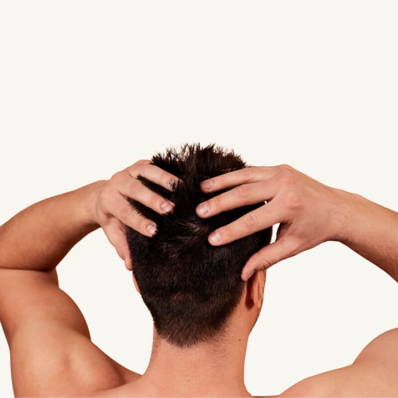 Kako prirodni DHT blokatori mogu pomoci kod opadanja kose?