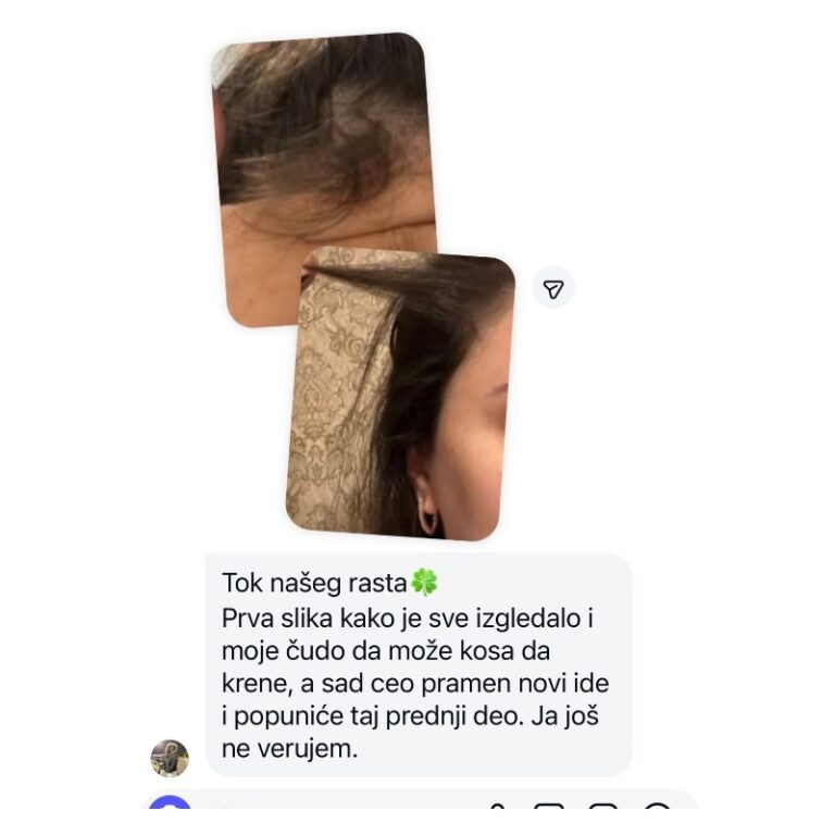 sampon za rast kose promen