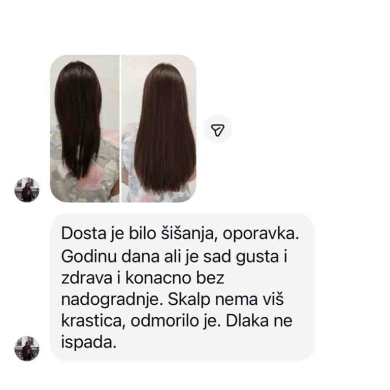 sampon za rast kose promena