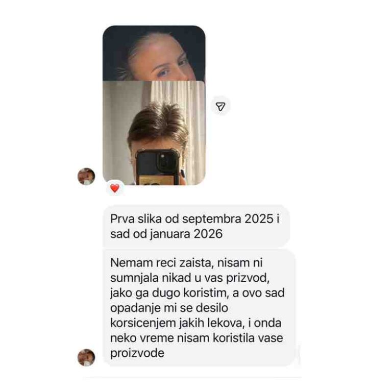 sampon za rast kose promena