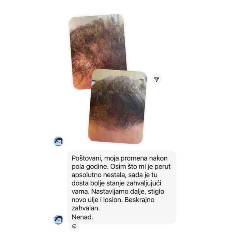 sampon za rast kose promena