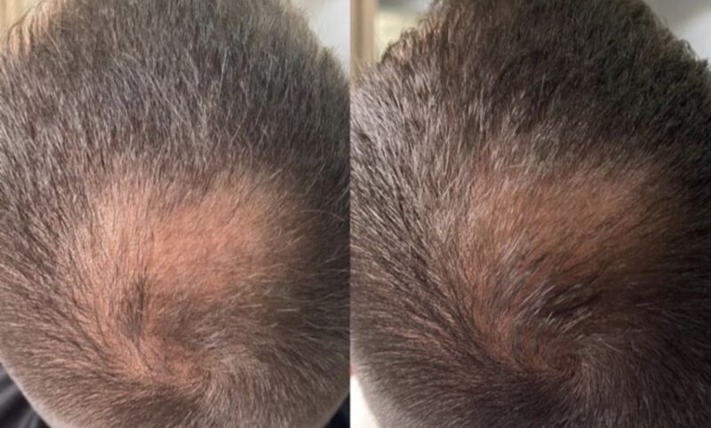 Image #1 from nENAD V.